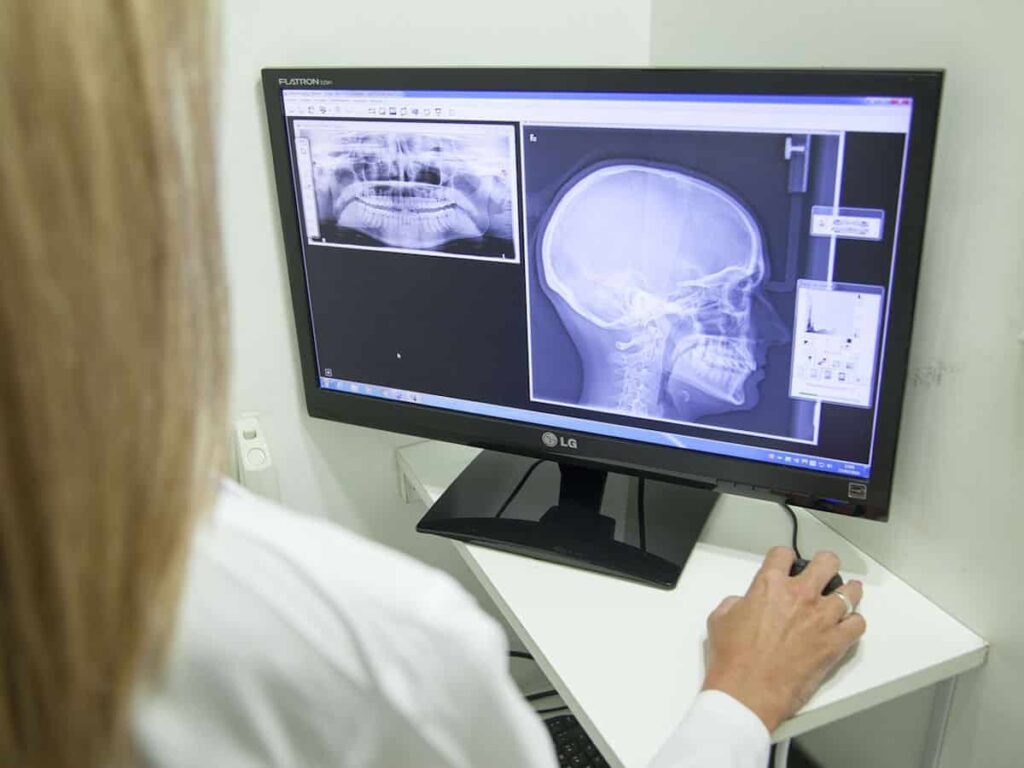 Desvendando a tecnologia por trás dos Raios X médicos